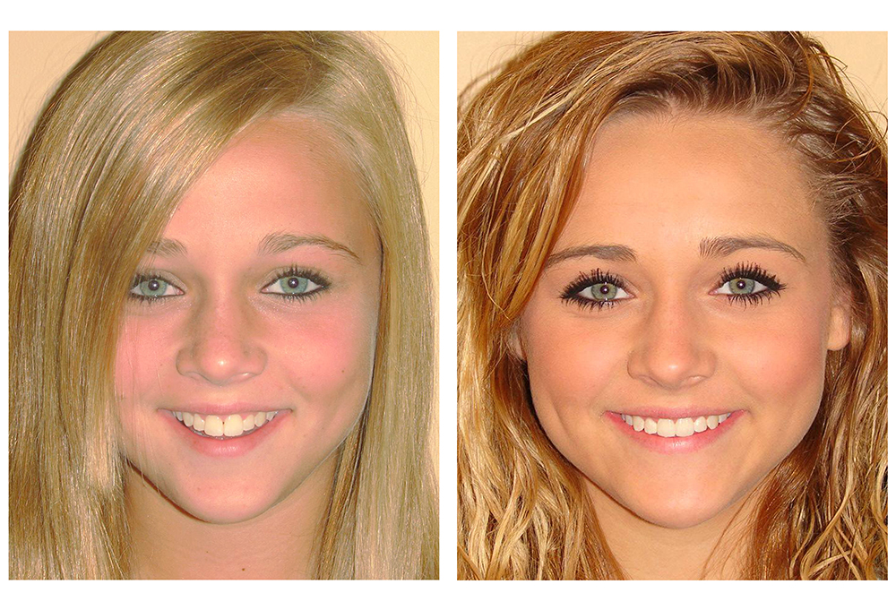 Brown Family Dentistry Group