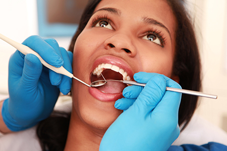 Brown Family Dentistry Group | Fluoride Treatment, Extractions and Oral Exams